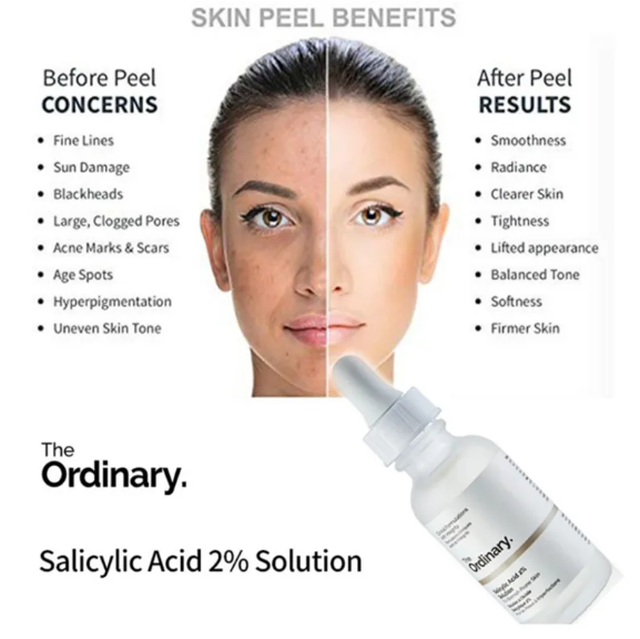 The Ordinary Salicylic Acid 2% Solution (30ml) - Image 4